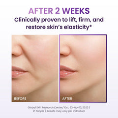 BIOHEAL BOH - Probioderm 3D Lifting Cream 50ml