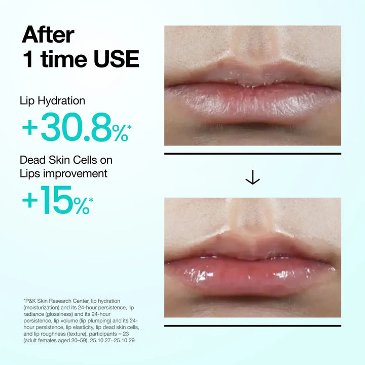 Anua PDRN Lip Serum Anua