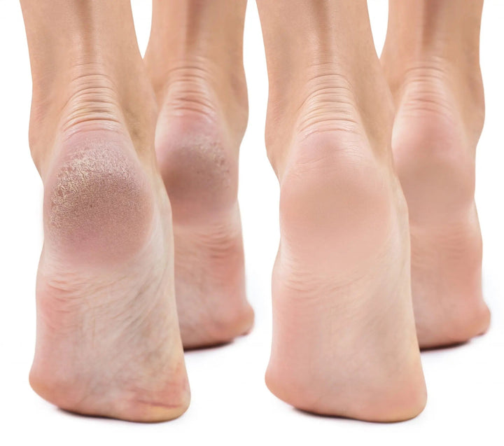 Innisfree Special Care Foot Mask Innisfree